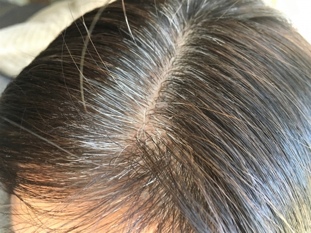 カラトリモニター