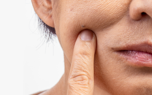 肌の乾燥がたるみの原因