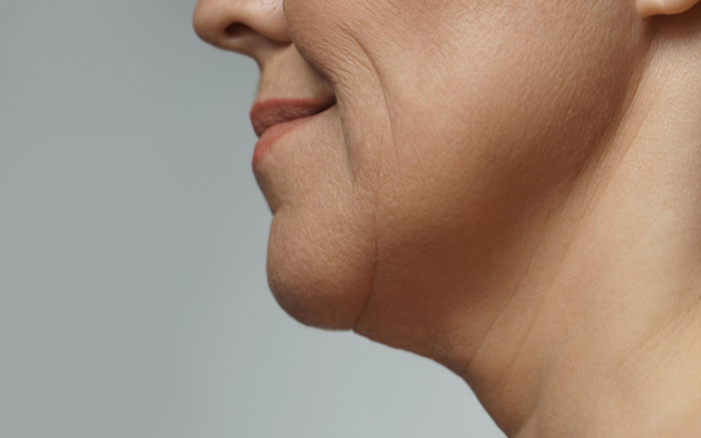 たるみの原因と対策