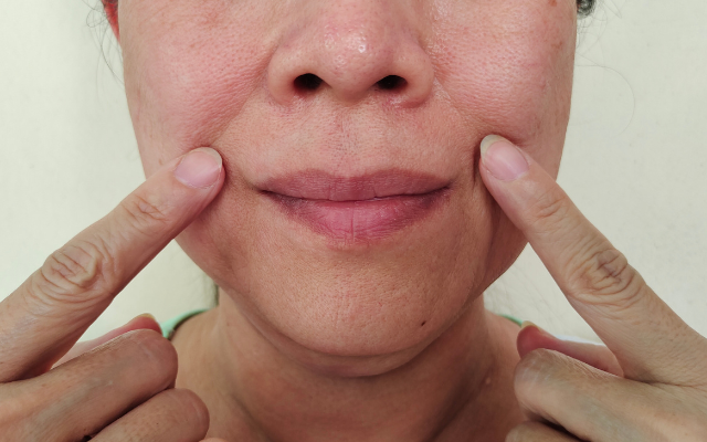 たるみケアライブセミナー