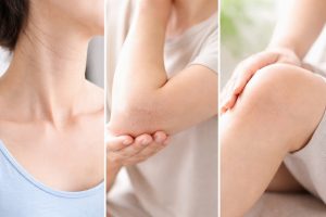 人に見せないからこそ差が出る！首・肘・膝の裏年齢