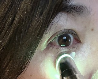 DAMTIX ボリュームリフト アイクリーム｜EMS搭載のデバイス一体型クリーム