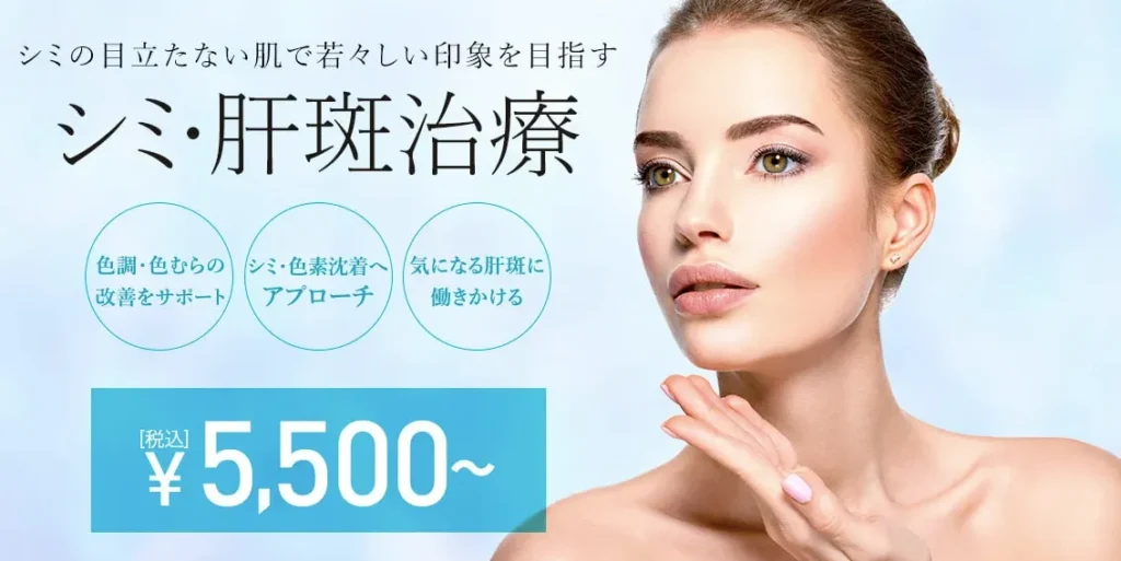 TCB シミ取り治療