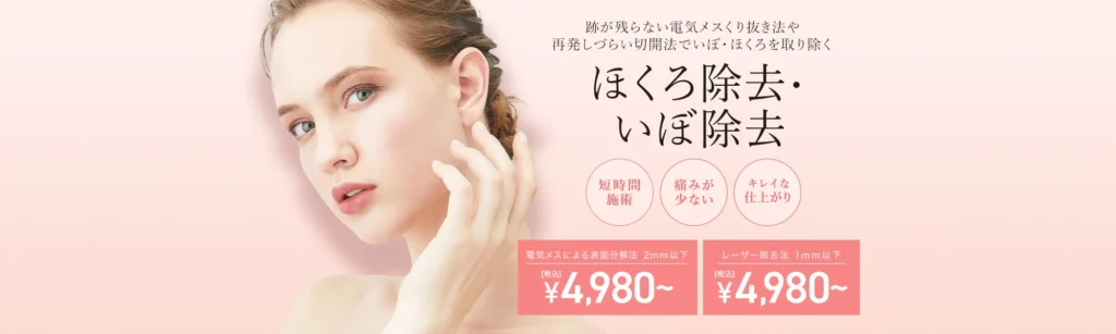 TCBほくろ取り4,980円