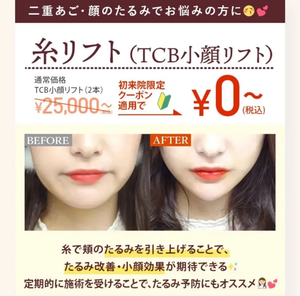 TCB小顔リフト