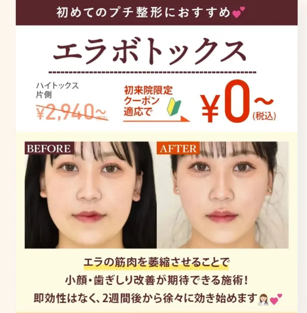 TCBエラボトックス