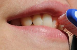 歯に自信を持ちたい！歯の黄ばみの原因や対策を知って白い歯を目指そう