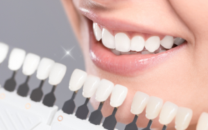 【無料体験あり】歯科クリニックの5分の1の価格で白い歯をゲット！HAKUの秘密を大公開